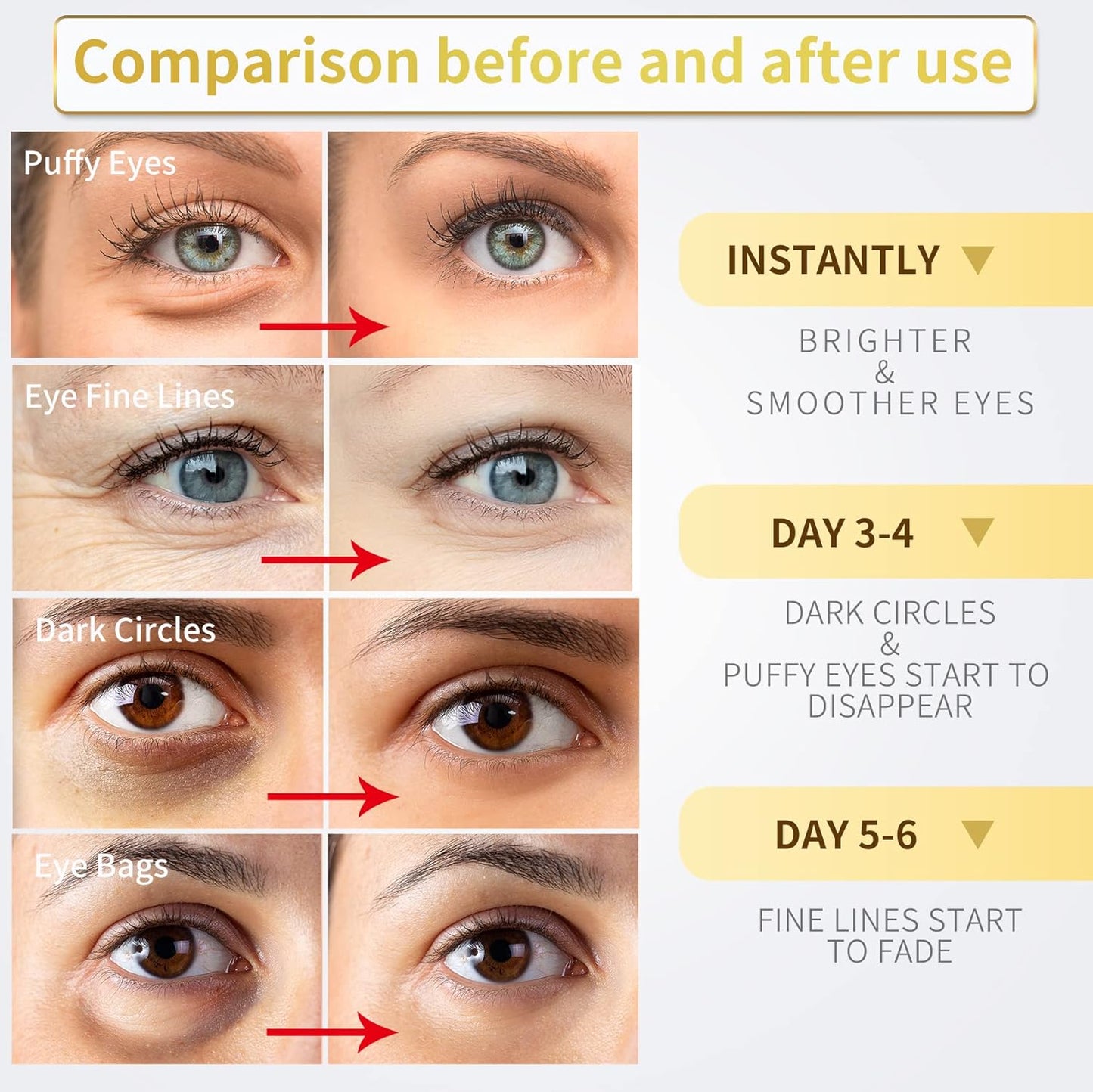 24K Gold Under Eye Patches – 60pcs for Dark Circles, Puffiness & Wrinkles Care - Cart Shape