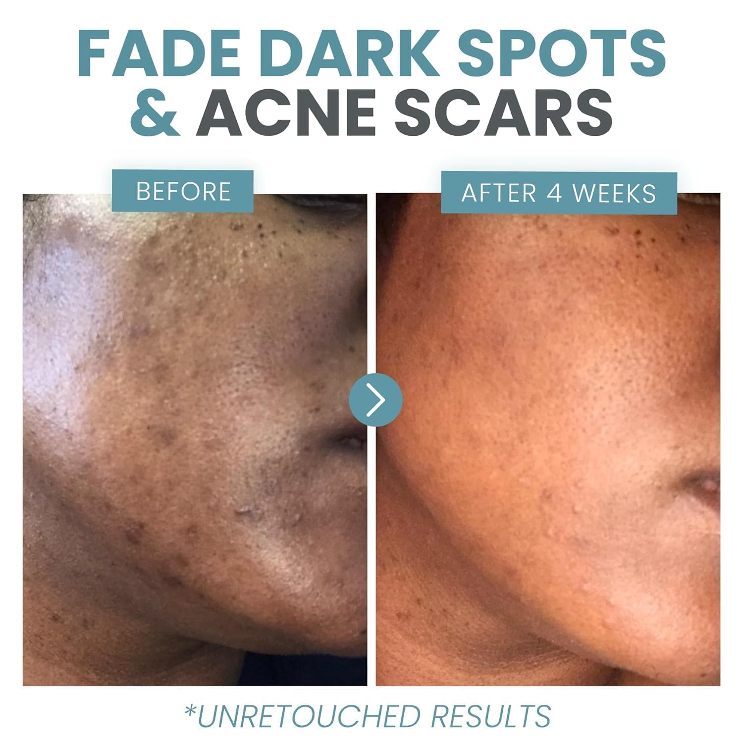 Eva Naturals Vitamin C Serum with Hyaluronic Acid - Anti-Aging, Acne & Dark Spot Care - Cart Shape