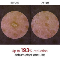 Peel Shot Glow Black Rice Ampoule - Soft Exfoliating Scrub & Blackhead Remover 80ml - Cart Shape