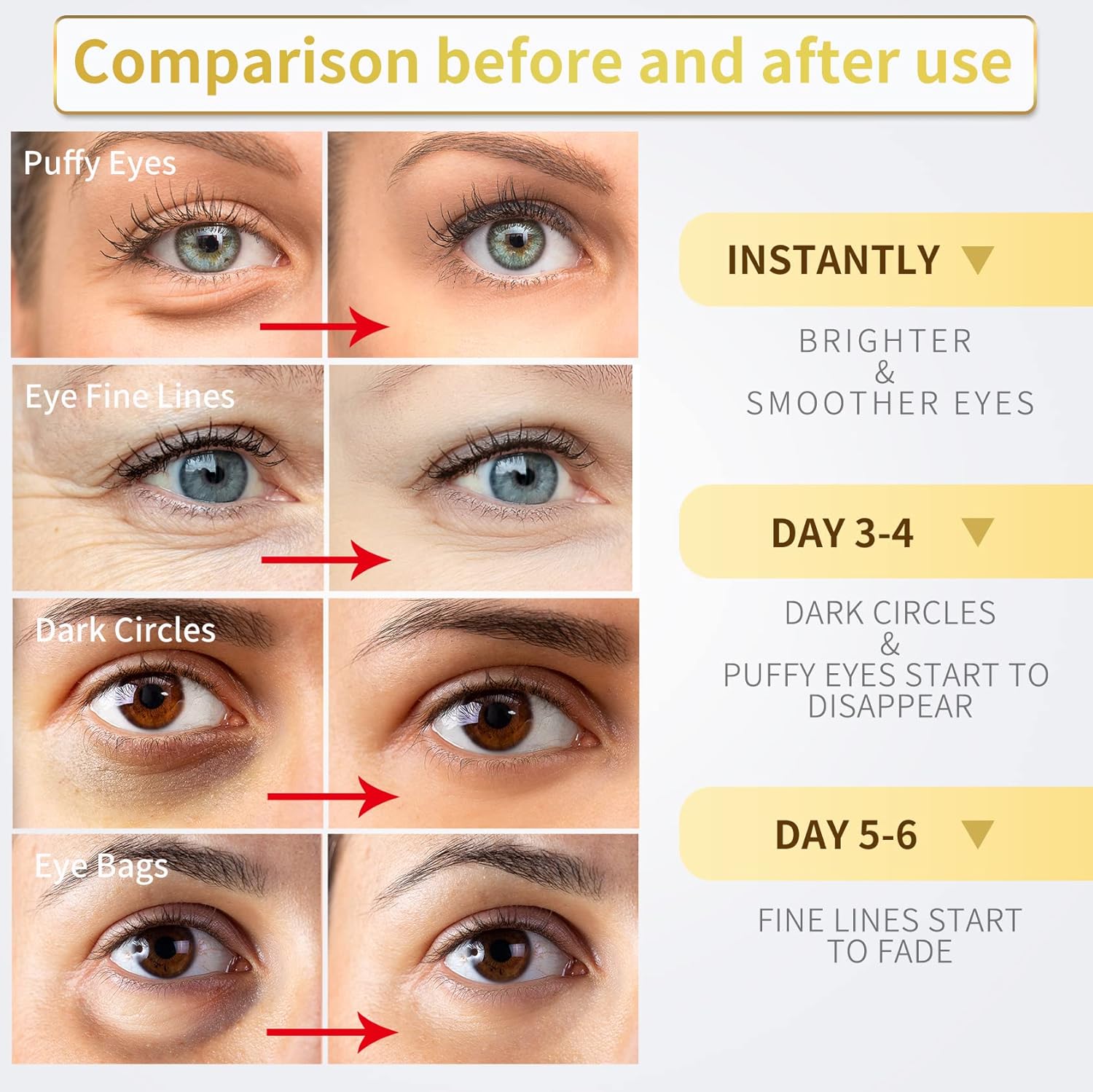 24K Gold Under Eye Patches – 60pcs for Dark Circles, Puffiness & Wrinkles Care - Cart Shape