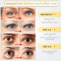 24K Gold Under Eye Patches – 60pcs for Dark Circles, Puffiness & Wrinkles Care - Cart Shape