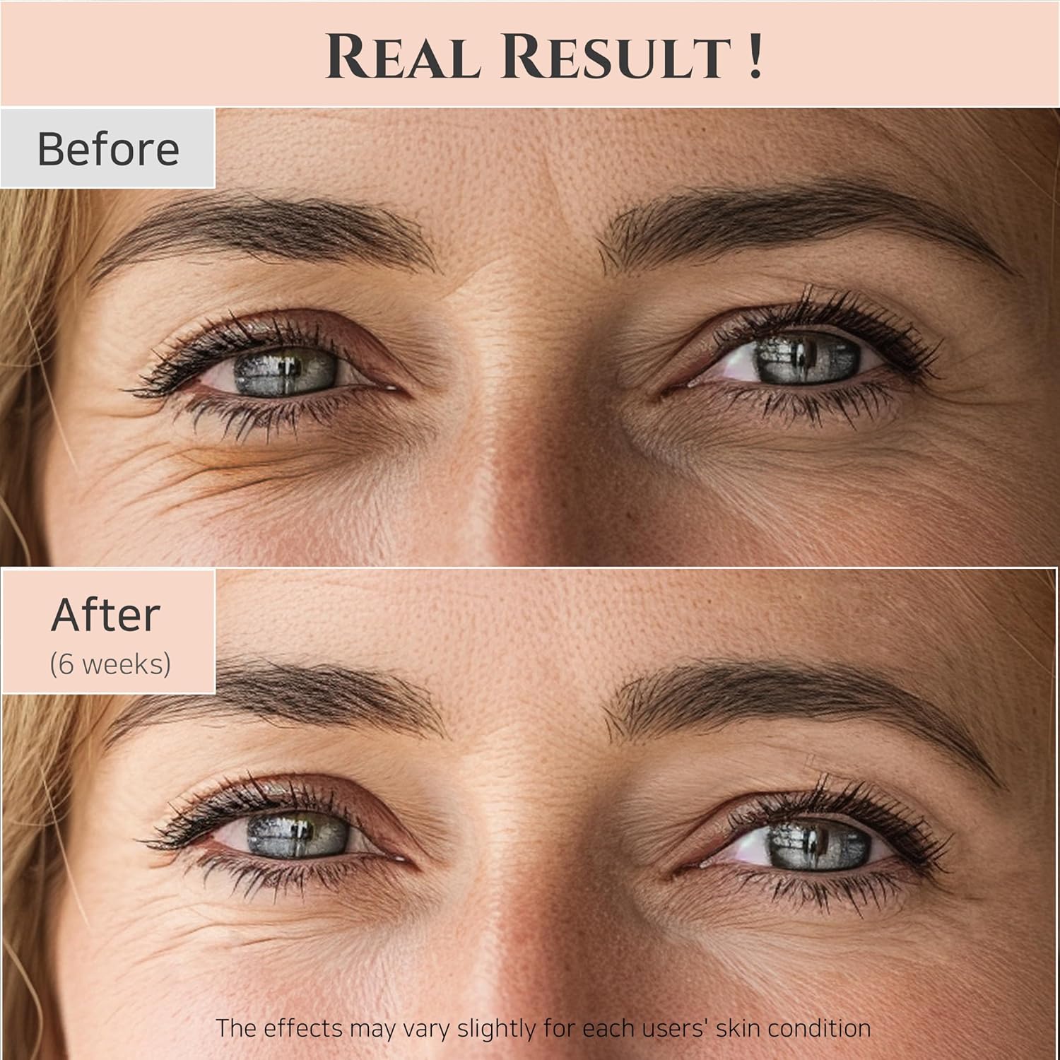 Joseon Revive Eye Serum with Retinal & Niacinamide for Puffy Eyes, Wrinkles, Dark Circles - Cart Shape