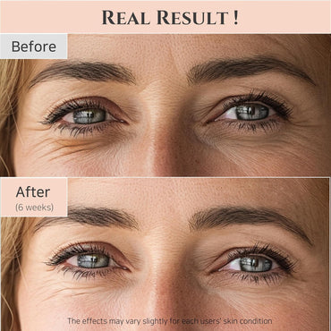 Joseon Revive Eye Serum with Retinal & Niacinamide for Puffy Eyes, Wrinkles, Dark Circles - Cart Shape